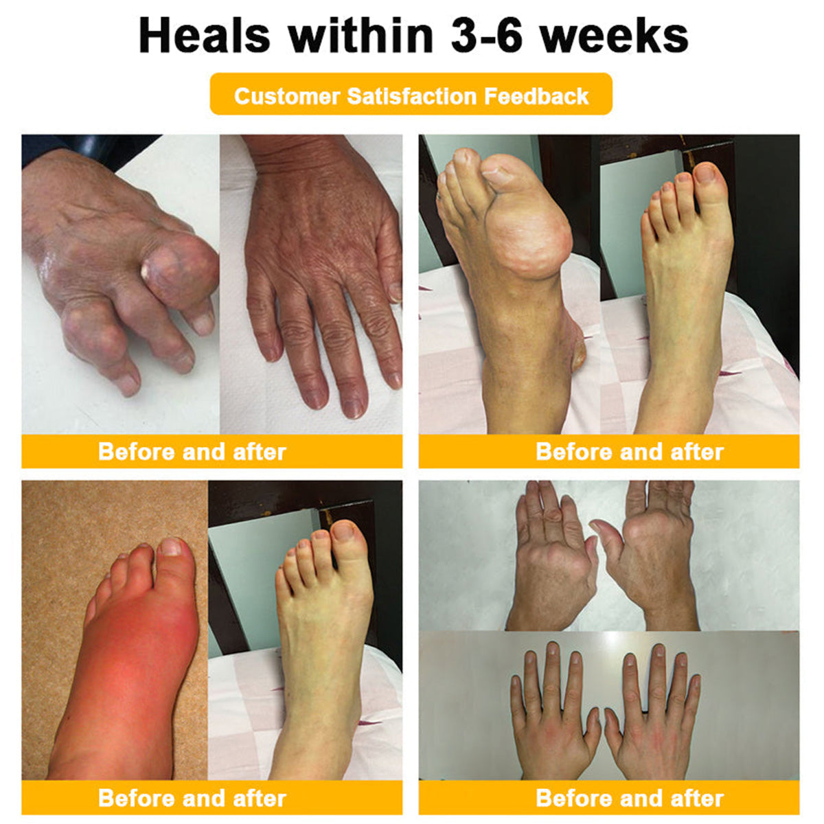 LOTMAY® Bee Venom Pain-Relief Bone Healing Cream 🐝🐝(Designed specifically for middle-aged and elderly people & NHS recommends)