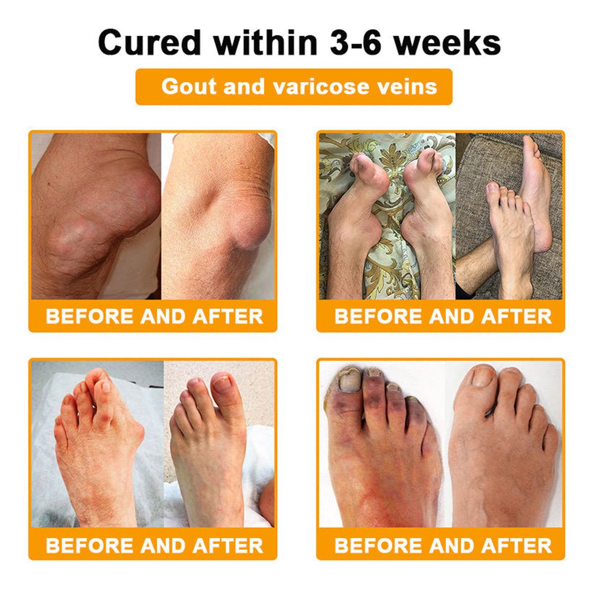 LOTMAY® Bee Venom Pain-Relief Bone Healing Cream 🐝🐝(Designed specifically for middle-aged and elderly people & NHS recommends)