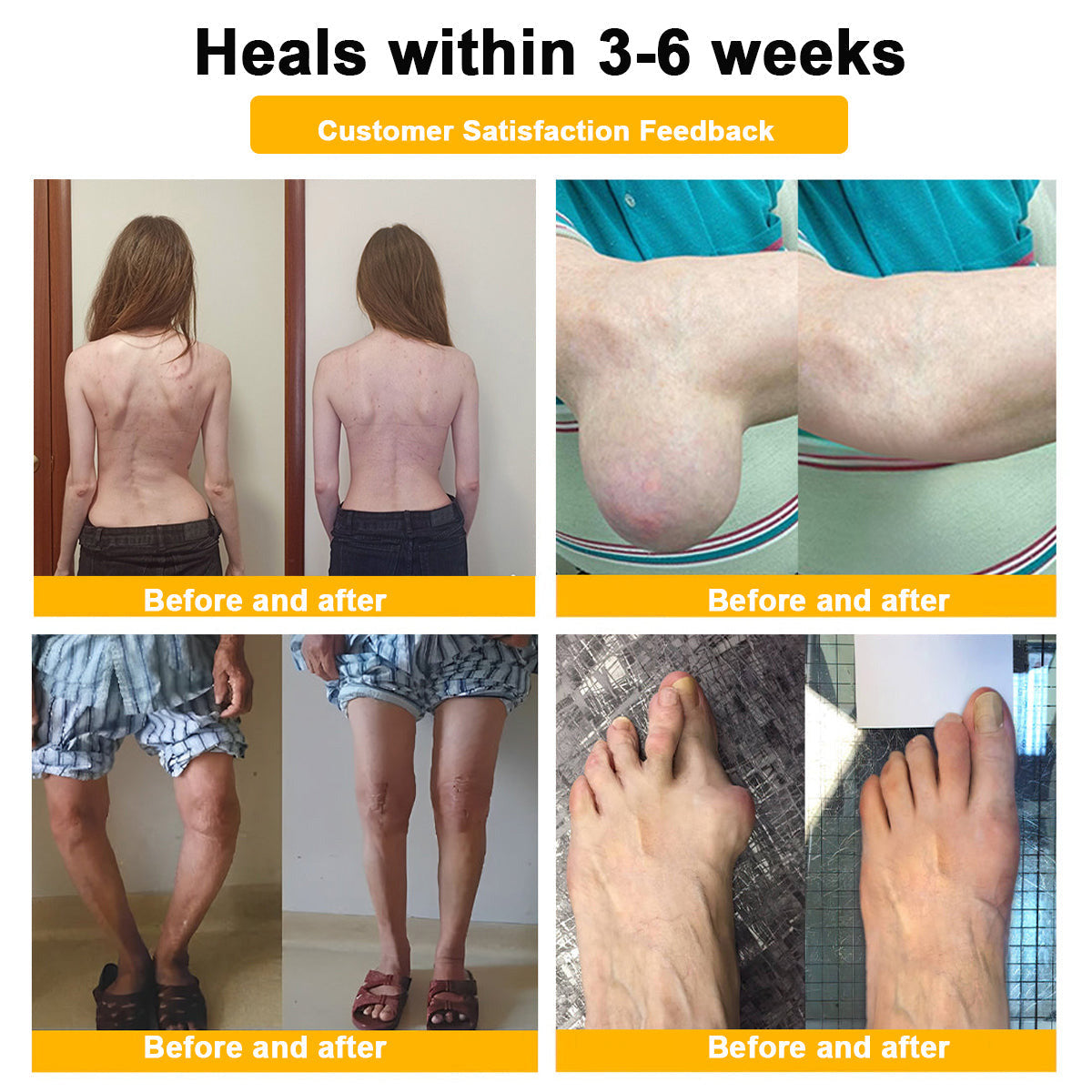 LOTMAY® Bee Venom Pain-Relief Bone Healing Cream 🐝🐝(Designed specifically for middle-aged and elderly people & NHS recommends)
