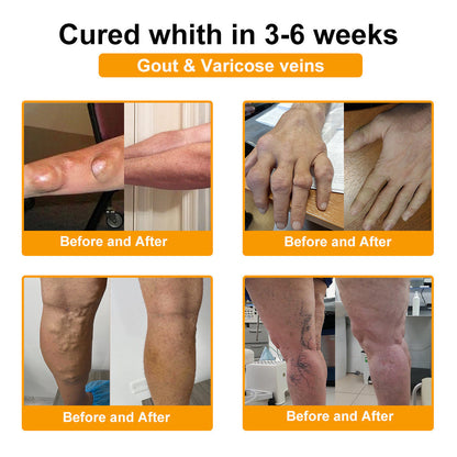 LOTMAY® Bee Venom Pain-Relief Bone Healing Cream 🐝🐝(Designed specifically for middle-aged and elderly people & NHS recommends)