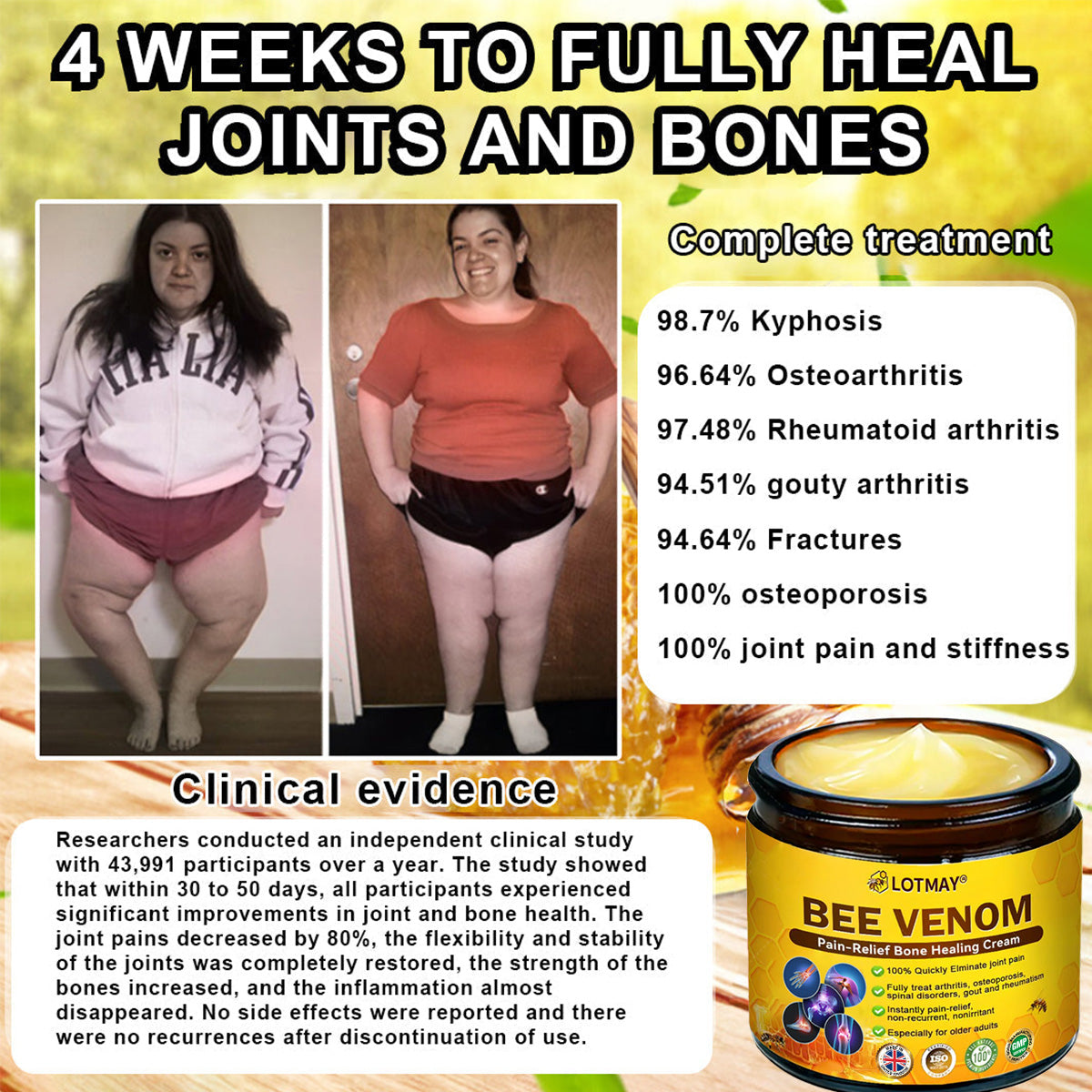LOTMAY® Bee Venom Pain-Relief Bone Healing Cream 🐝🐝(Designed specifically for middle-aged and elderly people & NHS recommends)
